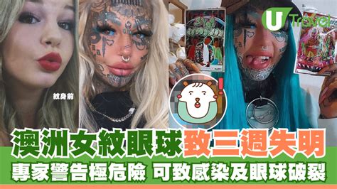 紋眼白|澳洲「龍女」藍眼球舌頭分叉 稱改造身體助抗抑鬱